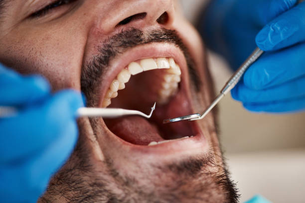 Best Emergency Dental Care for Trauma or Injury in Grand Bay, AL