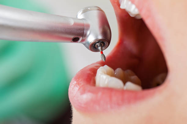 Best Same-Day Emergency Dentist in Grand Bay, AL